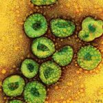 SARS Virus