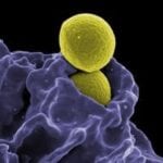 Neutrophil (purple) ingesting Staphylococcus aureus bacteria (yellow)