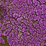 Methicillin-resistant Staphylococcus aureus (NIAID)