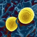 Staphylococcus aureus bacteria (NIAID RML)