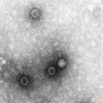 Poliovirus