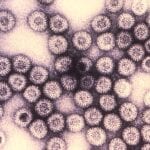 Rotavirus