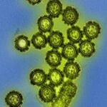 H1N1 influenza virus particles