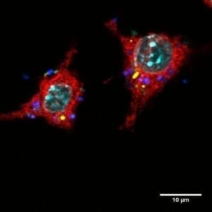 E-Coli Infected Macrophage