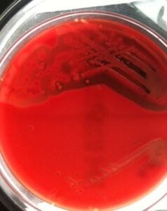 MRSA Strain