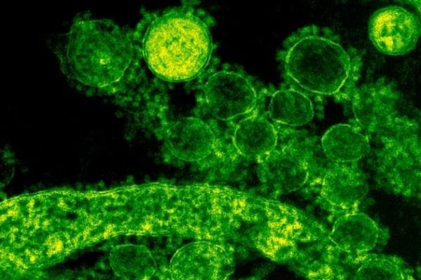 CDC Announces Entry Screening to Begin at LAX, SFO and JFK for Novel Coronavirus