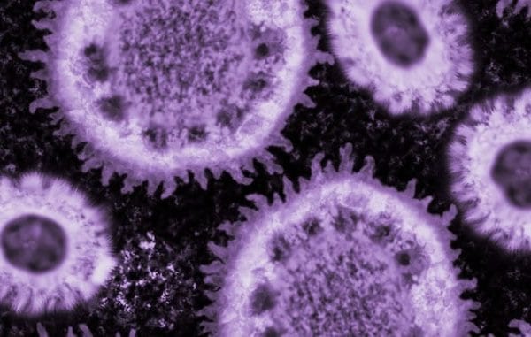 Coronavirus Deaths Are So Far Mostly Older Men, Many With Previous Health Issues