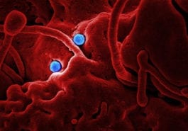MERS CoV Coronavirus