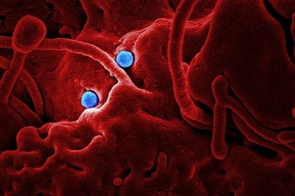 Japan Confirms First Case of New China Coronavirus 2019-nCoV