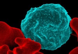 Malaria Infected Red Blood Cells