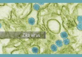 Zika Virus Diagnostics and Countermeasure Development