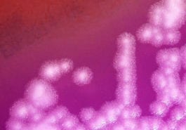 Bacillus anthracis rapid diagnostic development