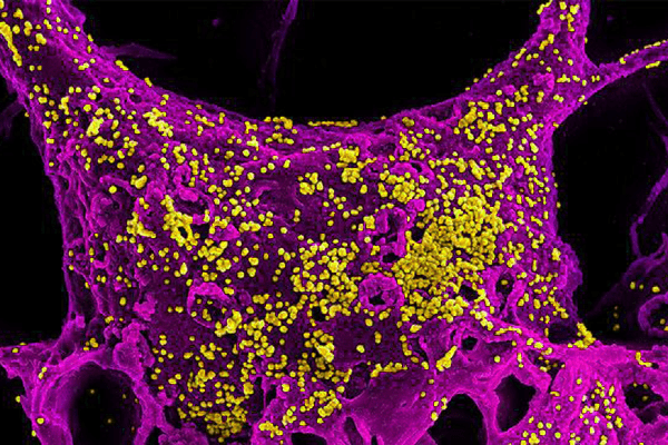 Novel Coronavirus R0 1.4-2.5 According to Preliminary Estimates