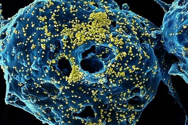 Biodefense Headlines: Hospital Ebola Preparedness, Animal BSL-3 Labs, Uganda’s Select Agent Tracking Program