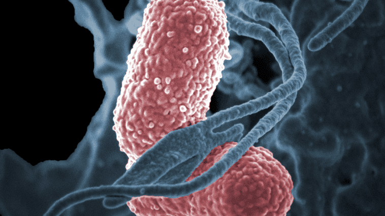 Klebsiella pneumoniae