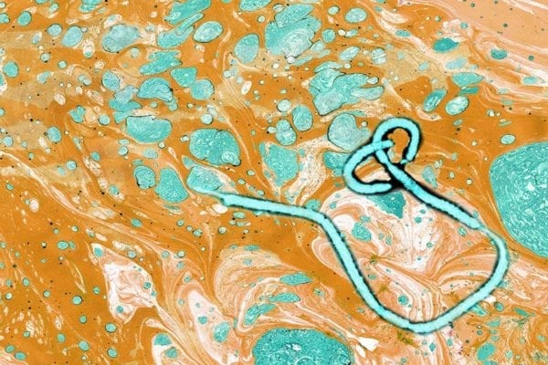 Burden of Measles on Public Health, Infectious Disease Physician Shortage, Ebola IHR Emergency Committee Meeting