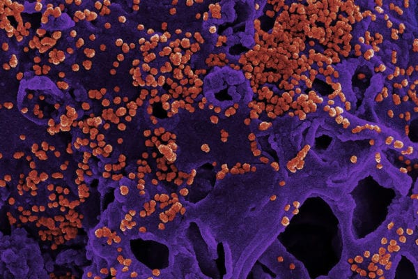 County of Santa Clara Public Health Department Reports First Case of Novel Coronavirus
