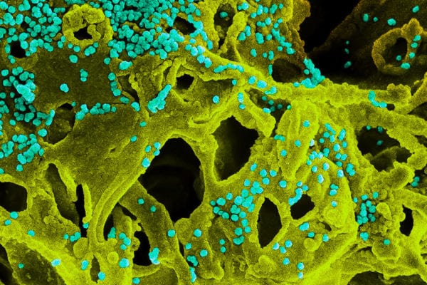Case of 2019 Novel Coronavirus Confirmed in Washington State Resident