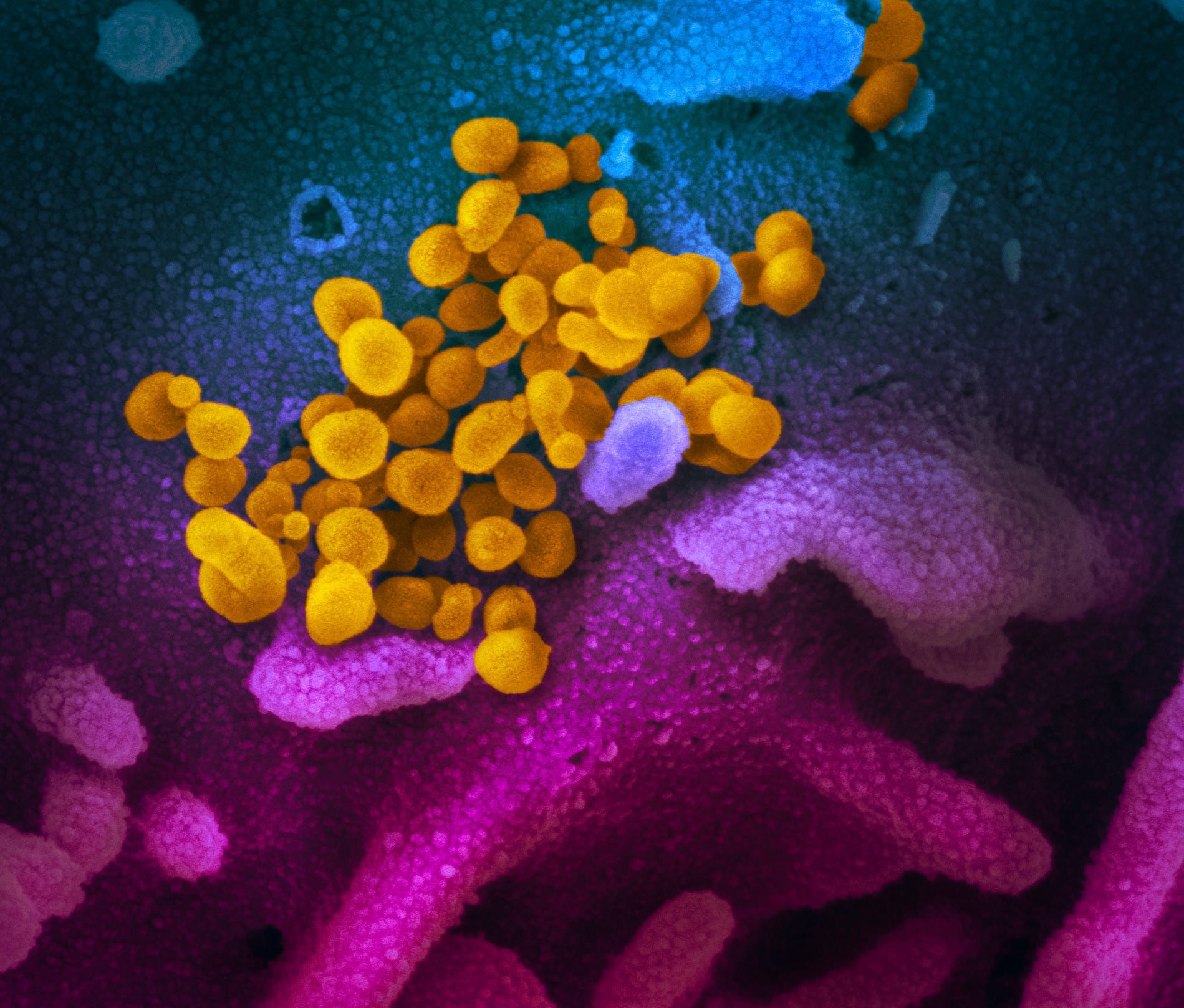 Image Of Coronavirus Covid 19