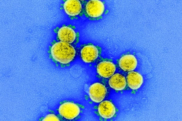 Coronavirus Pandemic Bond Payouts Likely to Be Held Up By Fine Print