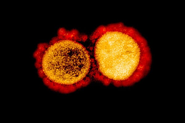 NIAID Issues Notice of Special Interest for SARS-CoV-2 and COVID-19 Research