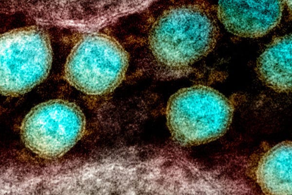 US Authorities Failing to Conduct Contact Tracing, a Cornerstone of Outbreak Response