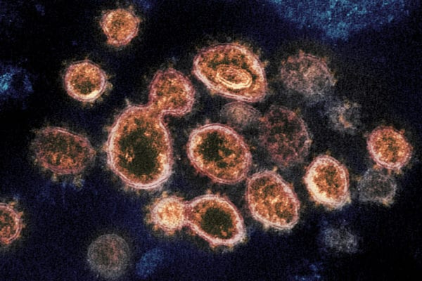 X-Ray Experiments Zero in on COVID-19 Antibodies