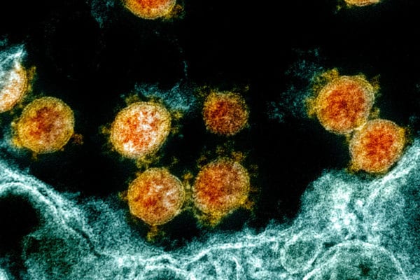 USF Study: COVID-19 Possibly Striking More Children Than Expected