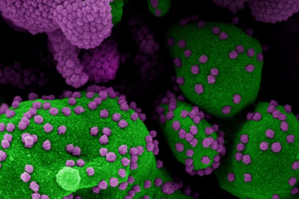 Building an ACE2 Receptor Trap for Pandemic Pathogens
