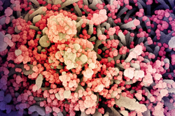 NIAID-Led Study of COVID-19 mRNA Vaccine Supports Advance to Phase 3 Human Trials