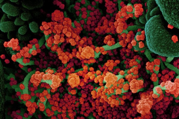 Detecting SARS-CoV-2 in the Environment