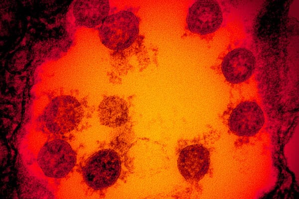 Finding the Golden Window for Collecting COVID-19 Survivor Antibodies