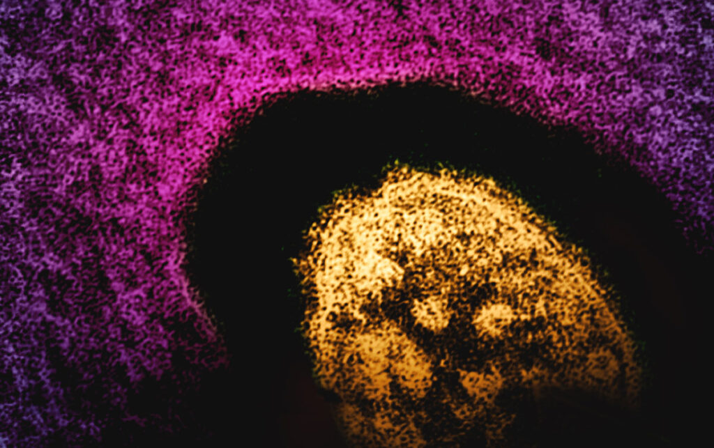 walnut-shaped virus particle