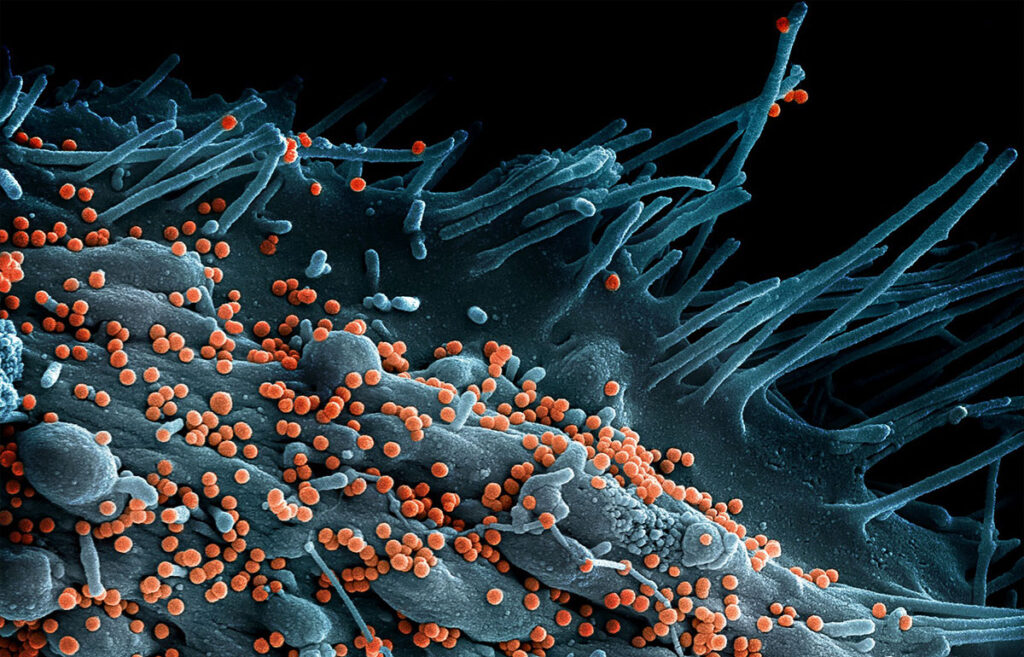 Scanning electron microscope image showing a dense cluster of spherical virus particles emerging from the surface of an infected cell, which appears covered in irregular folds and filament-like protrusions.