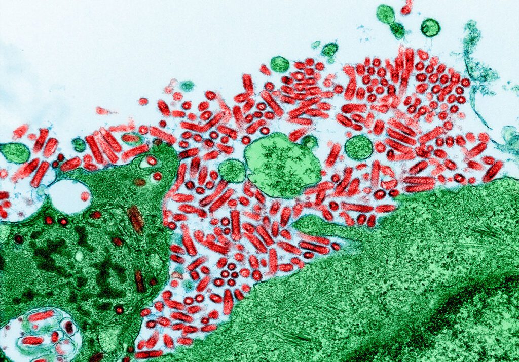 Electron micrograph showing numerous rod-shaped rabies virus particles surrounding and inside animal kidney cells. The viruses appear densely packed around the edges of the cells, which are shown with internal structures visible, indicating heavy infection. This image was captured in a laboratory setting to study how the rabies virus spreads within host cells.