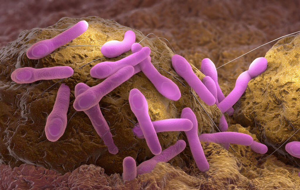 Microscopic illustration of rod-shaped Clostridium botulinum bacteria clustered on a textured food surface. The bacteria are elongated with smooth contours and appear to be attached to the food substrate, emphasizing the risk of contamination in improperly processed foods.