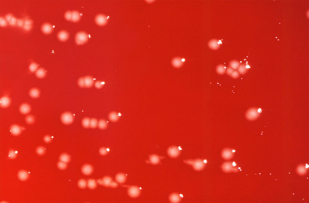 Petri dish showing dense bacterial growth with numerous round, slightly raised colonies of Citrobacter freundii, a Gram-negative, facultatively anaerobic bacterium. The colonies appear distinct and isolated, some forming small clusters, as they grow on a nutrient-rich blood agar medium. This image represents laboratory culture used to study antibiotic-resistant strains involved in healthcare-associated infections and global antimicrobial resistance.
