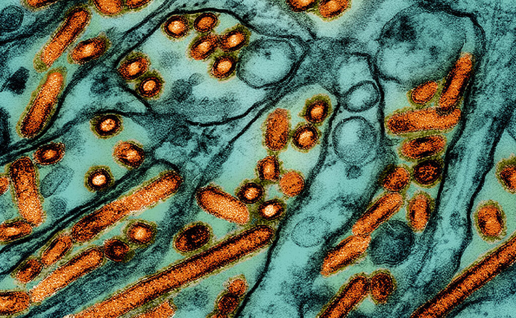 Electron microscope image showing numerous H5N1 avian influenza virus particles clustered within host epithelial cells. The virus particles are shaped like small cylinders or spheres and are tightly packed in groups, indicating active replication. They appear to be budding from the internal membranes of the host cells, which are visible as a complex network of cellular compartments. This high-magnification view reveals the intimate interaction between the virus and its cellular environment, providing insight into how the virus invades and multiplies within infected tissue.
