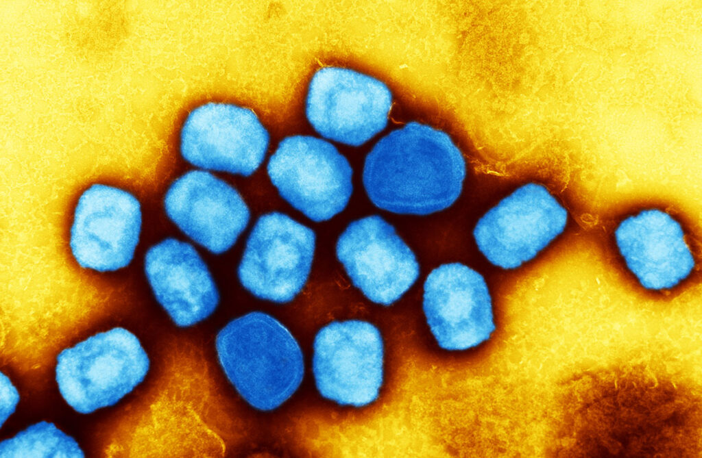 Transmission electron micrograph showing clustered mpox virus particles with rounded, brick-shaped morphology, cultivated and purified from a cell culture sample.