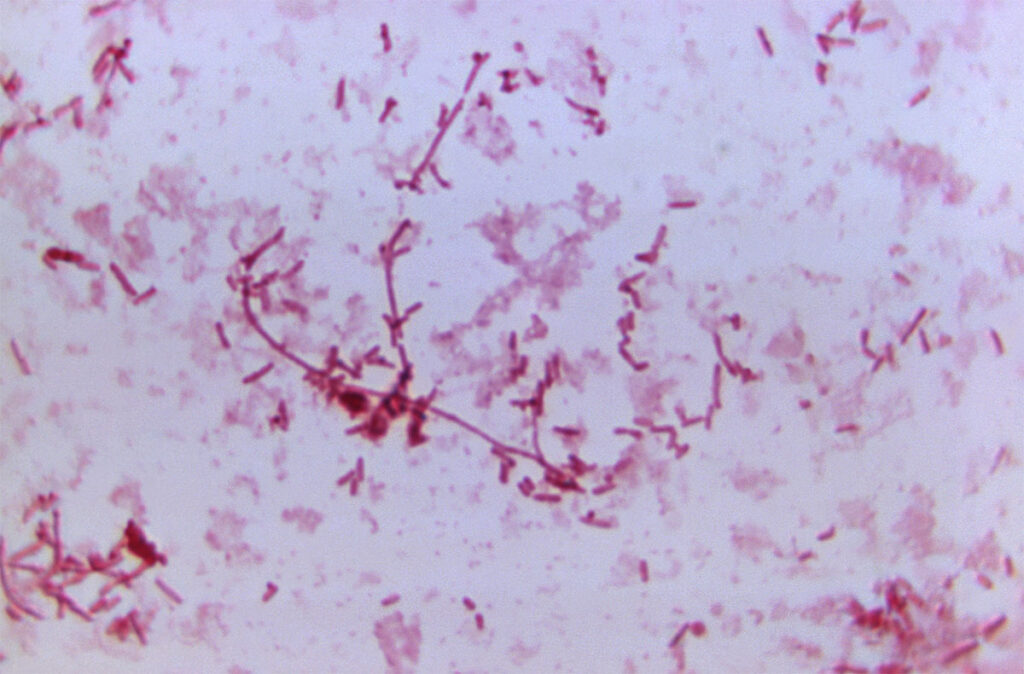 Highly magnified microscopic image showing numerous rod-shaped Yersinia pestis bacteria, some arranged in chains and clusters, dispersed across the visual field. The bacteria appear as slender, elongated rods with distinct groupings, typical of Gram-negative morphology. This image, taken at 1125X magnification, reveals the cellular structure and distribution pattern of the plague-causing organism, offering a detailed view relevant to microbiological and epidemiological research.