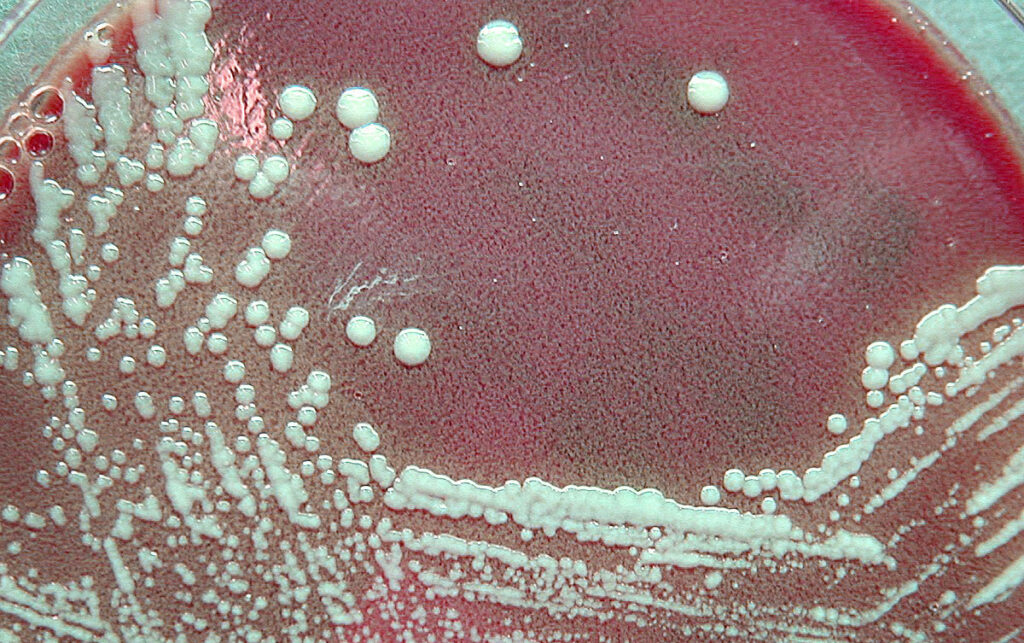 Close-up of a laboratory petri dish showing bacterial colonies with distinct rounded growth patterns, used in scientific research on tularemia vaccines.