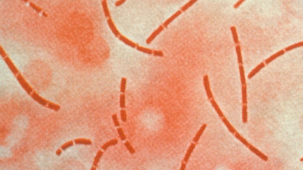 Highly magnified photomicrograph showing Bacillus anthracis bacteria. The organisms appear as long, straight rods connected end to end in characteristic chains, resembling strings of rectangular blocks. Each bacterium has squared-off ends, forming linear arrangements typical of anthrax bacilli. This structural detail illustrates the distinctive shape that aids in identification of the anthrax pathogen.