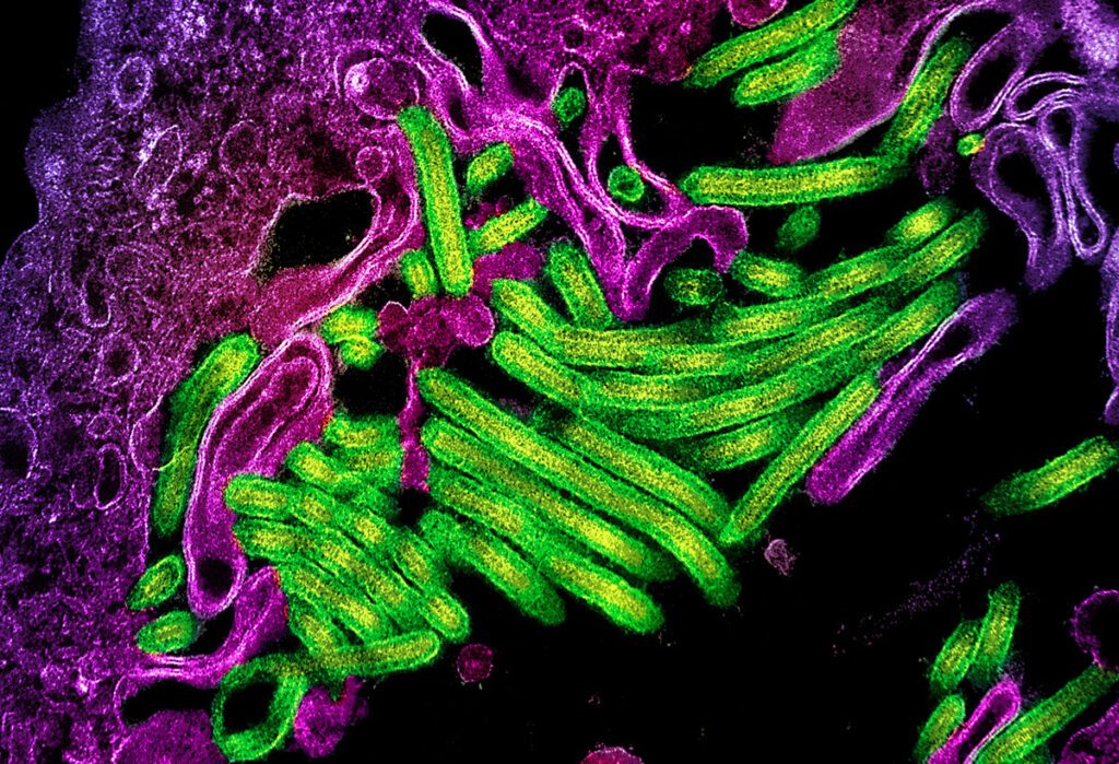 Containing a Crisis: Strengthening Ebola Response in the DRC’s Kasai Province Electron micrograph showing many Ebola virus particles, which appear as long, thin, thread-like filaments clustered together and emerging from the surface of infected African green monkey kidney cells, illustrating the virus’s filamentous shape and its process of budding from host cells.