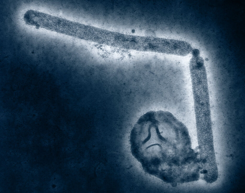 two rod-like structures