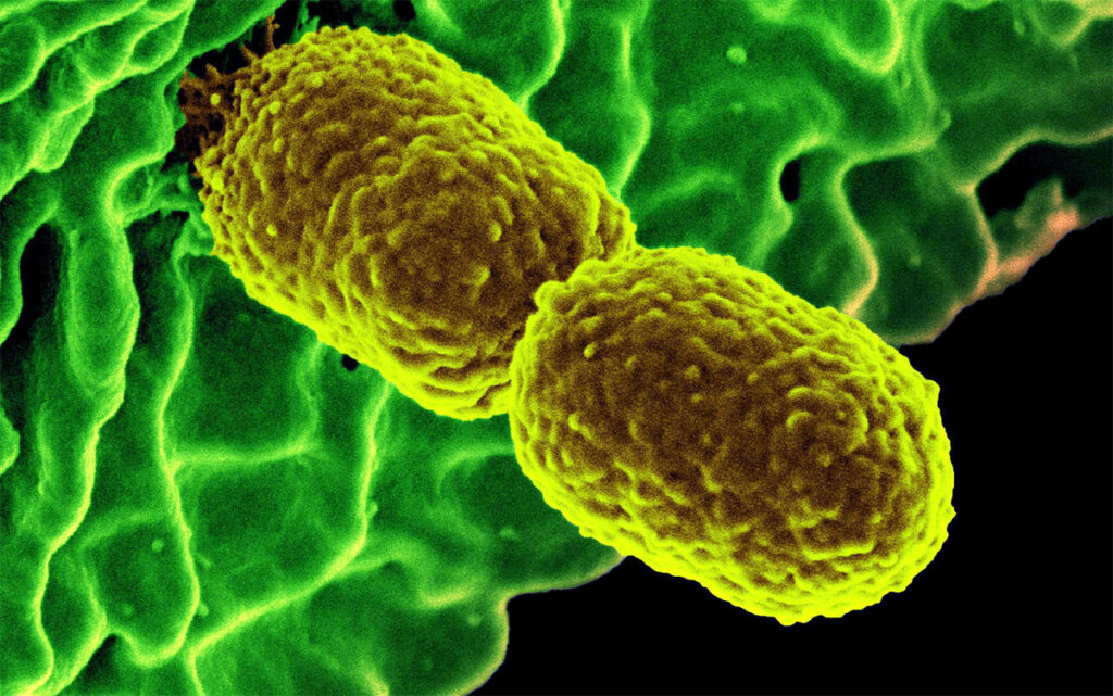 Identifying the Pathogens Behind Neonatal Deaths in Low-Resource Settings Rod-shaped bacteria linked seemingly like sausage links. Surface appears uniformly bumpy.