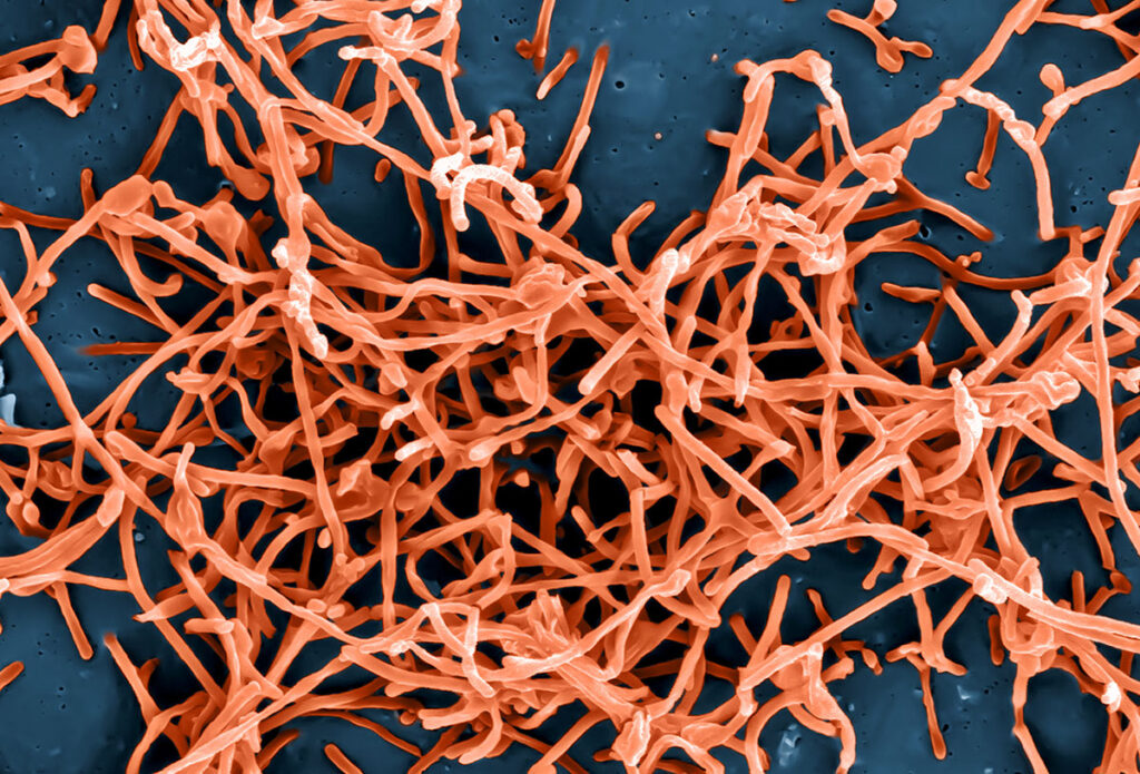 Numerous elongated, thread-like Ebola virus particles scattered across a dark background. The particles display the virus's distinctive filamentous shape, with some appearing as long strands and others as tangled clusters. Small spherical elements and cellular debris are visible among the viral structures.