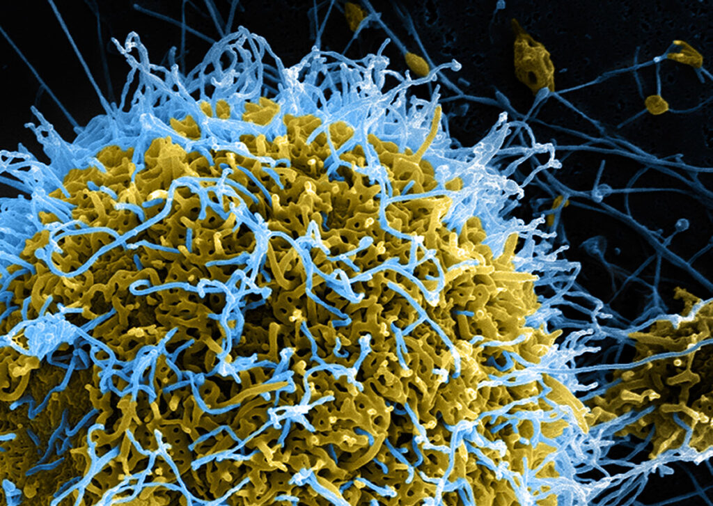 Ebola Case Confirmed in France After Health Worker Returns from DRC Response Deployment A scanning electron microscope image showing Ebola virus particles at high magnification. Thread-like viral filaments rendered in light blue emerge and spread across infected cellular material shown in yellow. The particles display the characteristic filamentous morphology of filoviruses, with multiple elongated strands extending from the cellular surface. Individual viral particles and tangled clusters of filaments are visible throughout the image.