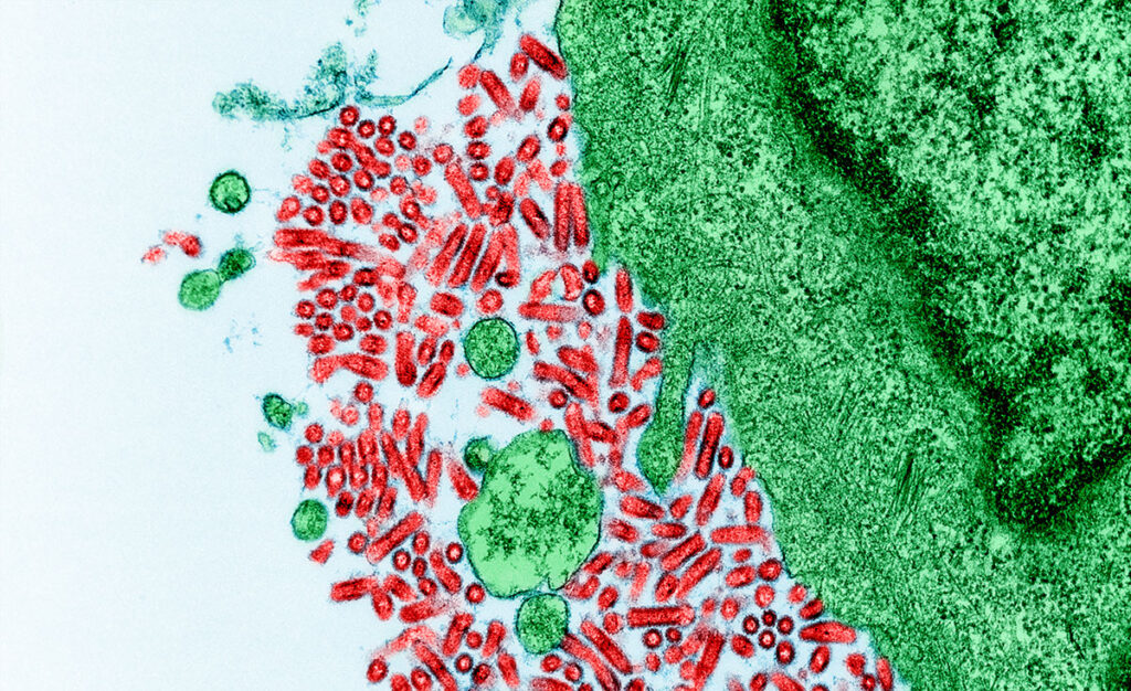 A transmission electron microscope image showing infected cells with numerous viral particles visible. Large rounded infected cells are interspersed with smaller viral particles scattered throughout the cellular material. The cells display dense viral replication with visible cytoplasmic structures and cellular debris. The image captures the characteristic appearance of heavy viral infection at the ultrastructural level.
