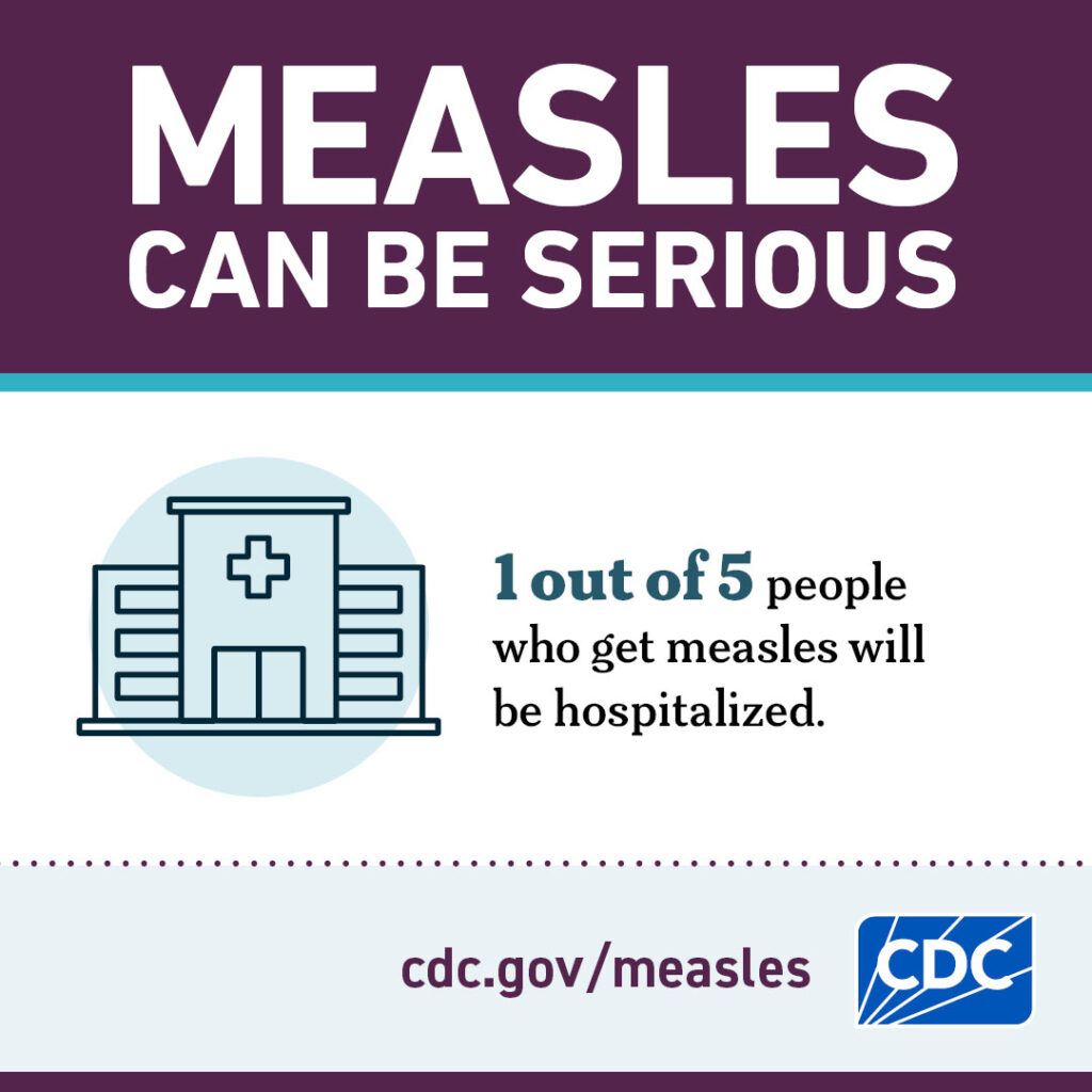 1 in 5 who get measles will be hospitalized.