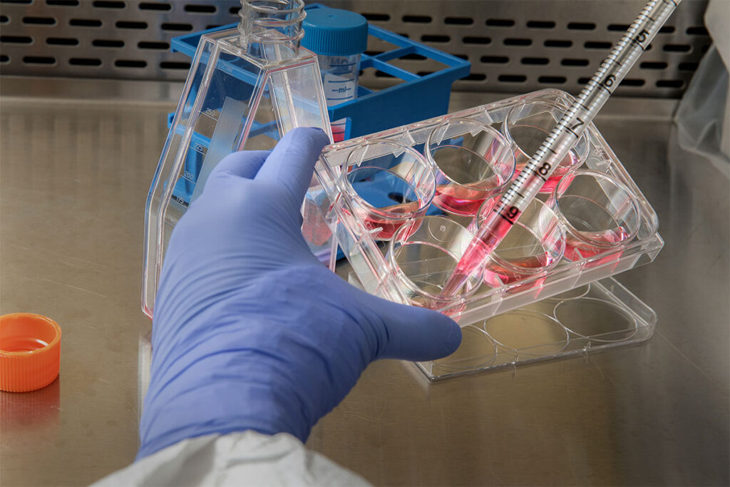 H5N1 from Dairy Cattle Detected in Laboratory Serum, Prompts Supply Chain Review A laboratory scientist wearing protective gloves manipulates a multi-well culture plate containing cell growth medium. The scientist holds the plate while examining individual wells filled with nutrient medium. Additional laboratory materials and equipment are visible in the background, including storage containers and supplies. The work demonstrates standard cell culture preparation procedures.